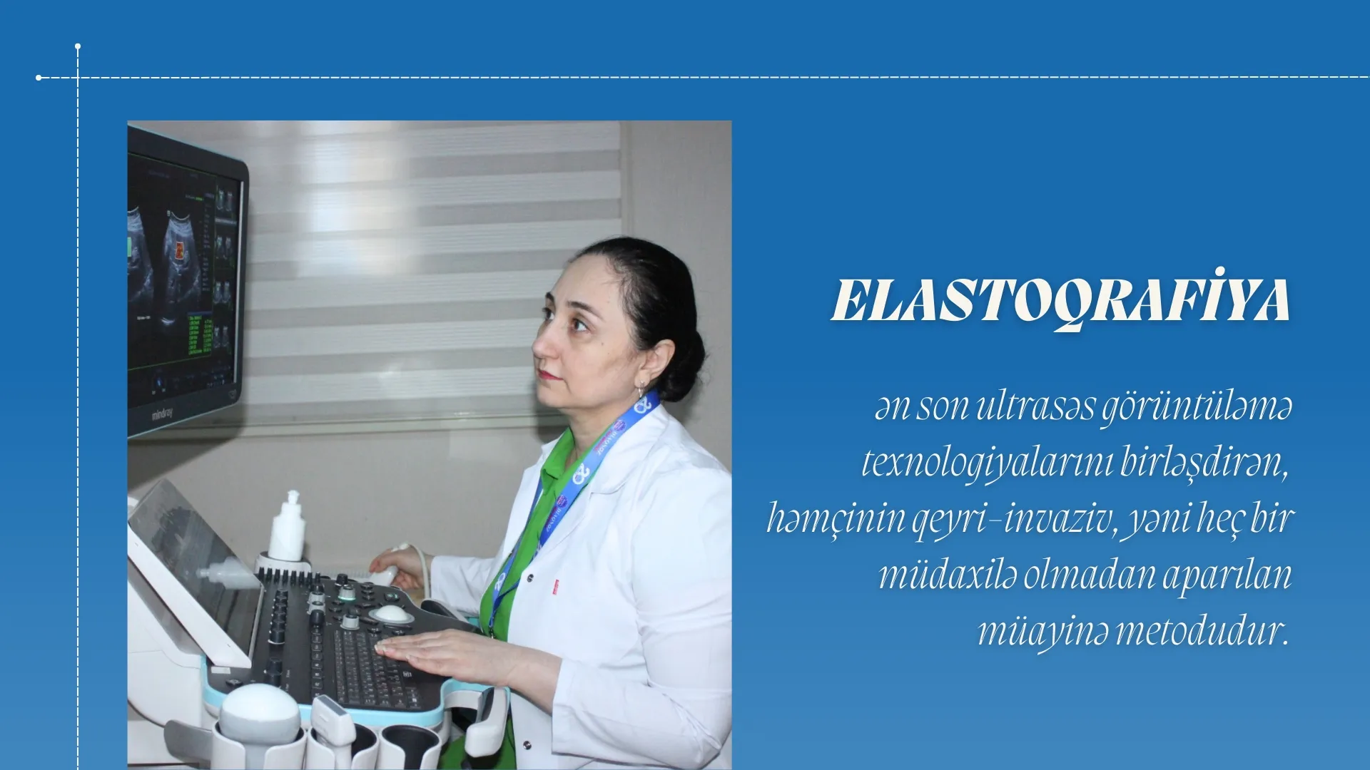 Elastoqrafiya Diaqnoz Tibb Mərkəzində! 