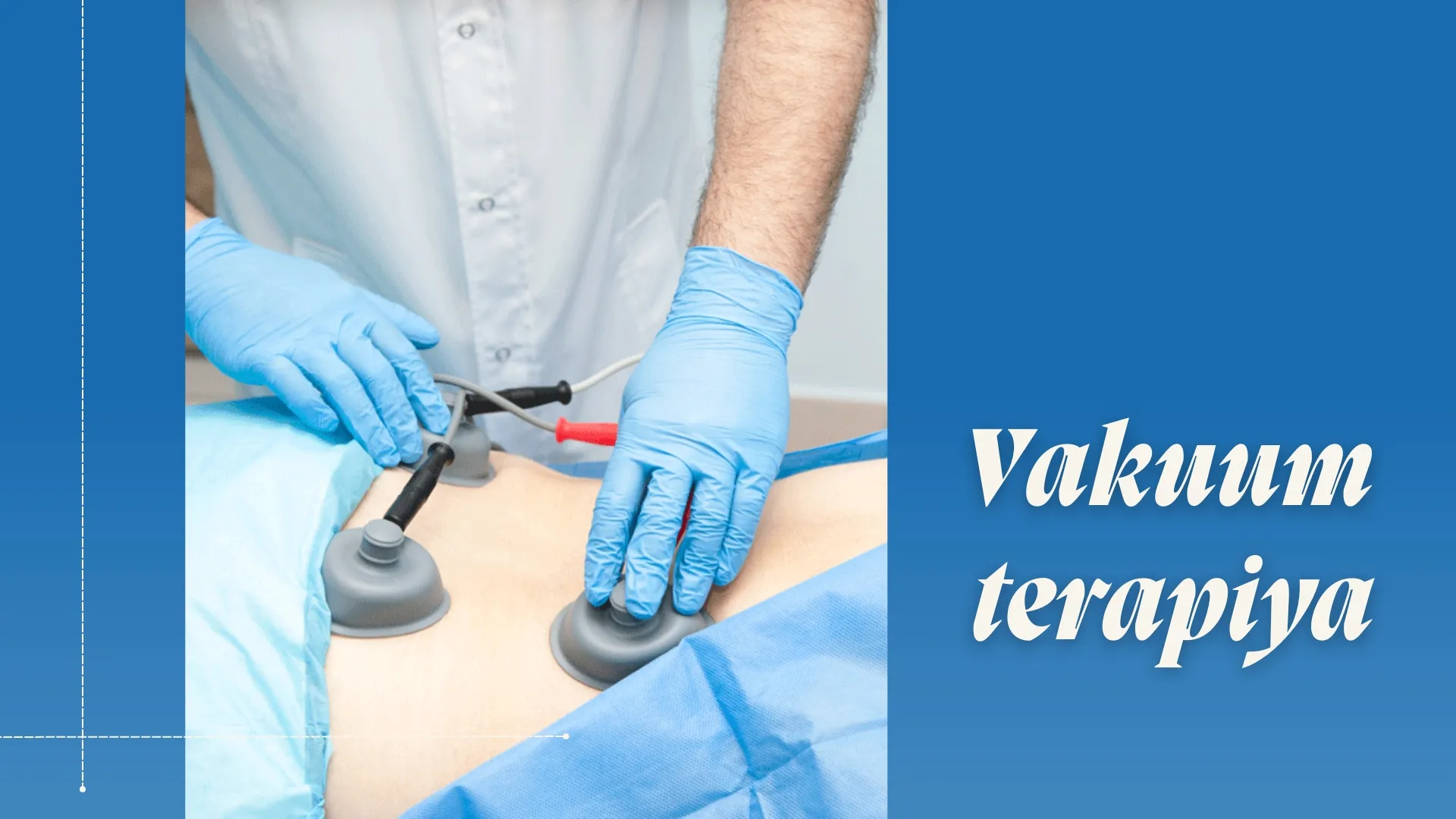 Vakuum terapiya 