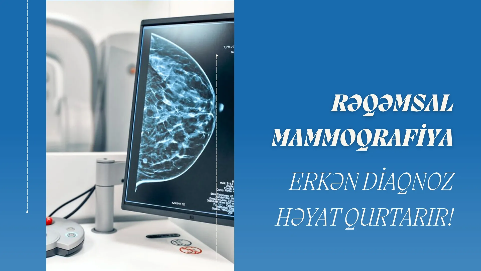 “Mammoqrafiya” haqqında məlumat - Diaqnoz Tibb Mərkəzinin Həkim-Radioloqu Dr. Könül Məmmədova 